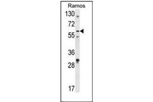 Western blot analysis of DCP1B Antibody (Center) in Ramos cell line lysates (35ug/lane).
