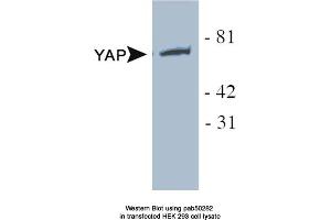 Image no. 1 for anti-Yes-Associated Protein 1 (YAP1) antibody (ABIN363591) (YAP1 anticorps)