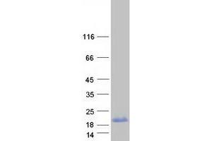 Validation with Western Blot