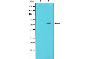 Western blot analysis of Chk1 expression in HeLa whole cell lysates,The lane on the left is treated with the antigen-specific peptide. (CHEK1 anticorps  (Internal Region))