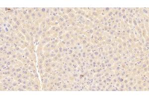Detection of a1BG in Mouse Liver Tissue using Polyclonal Antibody to Alpha-1-B-Glycoprotein (a1BG)