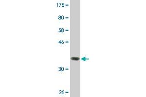 Western Blot detection against Immunogen (36. (ZFYVE16 anticorps  (AA 1-100))