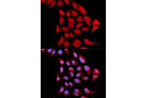 Immunofluorescence analysis of U2OS cells using PSMA6 antibody. (PSMA6 anticorps  (AA 1-246))