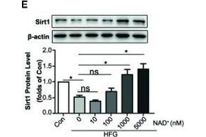 Trimetazidine (TMZ) upregulated Sirt1 expression depending on Nampt/NAD+ pathway in diabetic nephropathy. (SIRT1 anticorps  (AA 448-747))