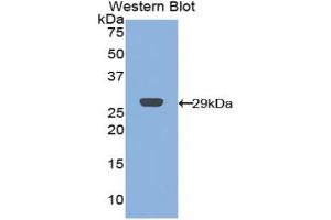 Detection of Recombinant CRP,Cavia using Polyclonal Antibody to C Reactive Protein (CRP) (CRP anticorps  (AA 20-225))