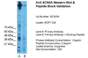 Host:  Rabbit  Target Name:  SCN5A  Sample Type:  MCF7 Whole Cell  Lane A:  Primary Antibody  Lane B:  Primary Antibody + Blocking Peptide  Primary Antibody Concentration:  1ug/ml  Peptide Concentration:  5ug/ml  Lysate Quantity:  25ug/lane/Lane  Gel Concentration:  0.