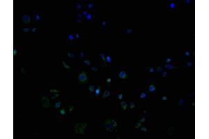 ImmunofluorescencestainingofPC3cellswithABIN7162195at1:100,counter-stainedwithDAPI.