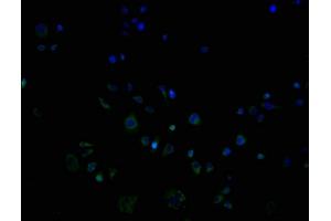 ImmunofluorescencestainingofPC3cellswithABIN7162195at1:100,counter-stainedwithDAPI. (OR9G1 anticorps  (AA 290-304))