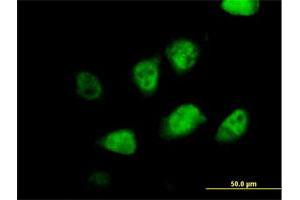 Immunofluorescence of purified MaxPab antibody to MLF2 on HeLa cell. (MLF2 anticorps  (AA 1-248))