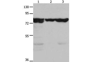 Western Blot analysis of Mouse kidney tissue, 293T and hela cell using HSP75 Polyclonal Antibody at dilution of 1:1500 (TRAP1 anticorps)