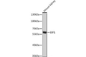 Western blot analysis of extracts of Mouse kidney using EBF1 Polyclonal Antibody at dilution of 1:1000. (EBF1 anticorps)