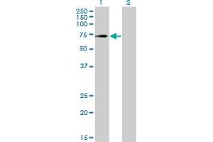 Western Blot analysis of TRIM32 expression in transfected 293T cell line by TRIM32 monoclonal antibody (M09), clone 2E5. (TRIM32 anticorps  (AA 105-204))