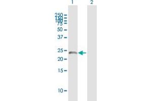 Western Blot analysis of SART3 expression in transfected 293T cell line ( H00009733-T01 ) by SART3 MaxPab polyclonal antibody.