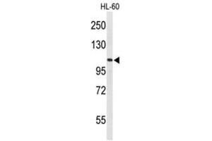 Western blot analysis of AF5q31 Antibody (N-term) in HL-60 cell line lysates (35µg/lane).