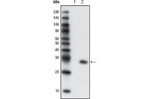 Western blot analysis using GFP mouse mAb against extracts from HCC827 cells, untransfected (1) and transfected with GFP(2).