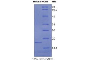 SDS-PAGE analysis of Mouse NOS3 Protein. (ENOS Protéine)