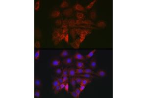 Immunofluorescence analysis of PC-12 cells using BiP/GRP78 Rabbit pAb (ABIN6134514, ABIN6142042, ABIN6142044 and ABIN6215180) at dilution of 1:100 (40x lens). (GRP78 anticorps  (AA 550-650))