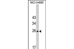 Western blot analysis of FKBP14 Antibody (N-term) (ABIN390491 and ABIN2840850) in NCI- cell line lysates (35 μg/lane). (FKBP14 anticorps  (N-Term))