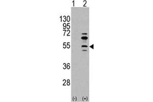 Western blot analysis of MEF2C antibody and 293 cell lysate (2 ug/lane) either nontransfected (Lane 1) or transiently transfected with the MEF2C gene (2). (MEF2C anticorps  (AA 37-66))