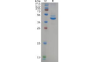Human NEFL Protein, hFc Tag on SDS-PAGE under reducing condition.