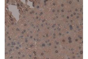 #VALUE! (TNP1 anticorps  (AA 3-53))