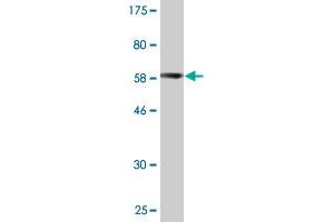 Western Blot detection against Immunogen (62. (PARVG anticorps  (AA 1-331))