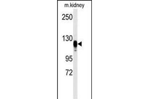 Western blot analysis of anti-EGFR Antibody  s in kidney heart tissue lysates (35 μg/lane). (EGFR anticorps  (AA 1048-1077))
