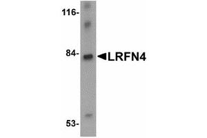 Image no. 1 for anti-Leucine Rich Repeat and Fibronectin Type III Domain Containing 4 (LRFN4) (C-Term) antibody (ABIN478053)