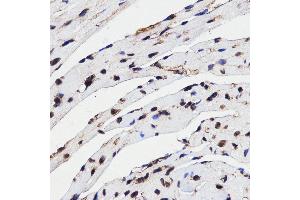 Immunohistochemistry (IHC) image for anti-High Mobility Group Box 1 (HMGB1) (AA 100-200) antibody (ABIN3023358) (HMGB1 anticorps  (AA 100-200))