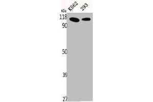 Western Blot analysis of K562 293 cells using p115 Polyclonal Antibody (USO1 anticorps  (C-Term))