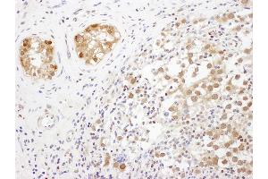 Immunohistochemistry (IHC) image for anti-Translin-Associated Factor X (TSNAX) (AA 240-290) antibody (ABIN7453532) (TSNAX anticorps  (AA 240-290))