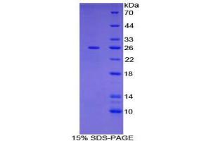 SDS-PAGE (SDS) image for Nectin cell adhesion molecule 3 (NECTIN3) (AA 90-293) protein (His tag) (ABIN1879100)