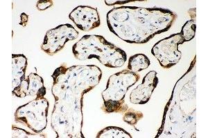 IHC-P: Nod1 antibody testing of human placenta tissue (NOD1 anticorps  (AA 1-160))