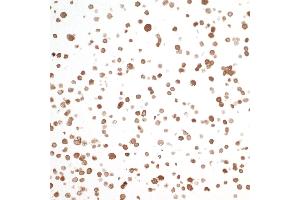 Immunocytochemistry (ICC) image for anti-Nicotinamide phosphoribosyltransferase (NAMPT) (AA 400-450) antibody (ABIN7454014) (Recombinant NAMPT anticorps  (AA 400-450))