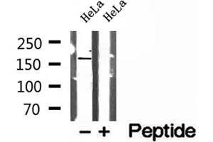 Western blot analysis of extracts of HeLa cells, using PTPN23 antibody. (PTPN23 anticorps  (C-Term))