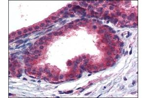 Immunohistochemistry Image: Human Prostate: Formalin-Fixed, Paraffin-Embedded (FFPE) (PPARD anticorps  (C-Term))