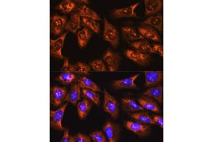 Immunofluorescence analysis of U-2 OS cells using RPS3 antibody (ABIN3023342, ABIN3023343, ABIN3023344 and ABIN6219623) at dilution of 1:100.