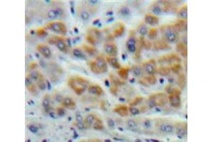 Used in DAB staining on fromalin fixed paraffin-embedded Liver tissue (Cystathionine (AA 14-224) anticorps)