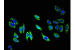 anti-tyrosine Kinase with Immunoglobulin-Like and EGF-Like Domains 1 (TIE1) (AA 217-328) antibody