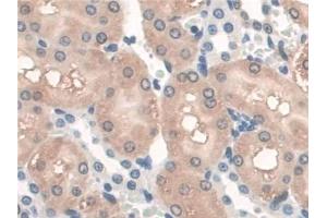 Detection of GAMT in Rat Kidney Tissue using Polyclonal Antibody to Guanidinoacetate-N-Methyltransferase (GAMT)