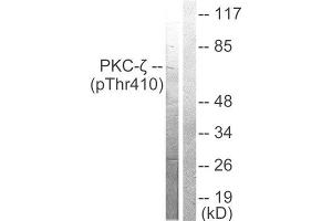 Western Blotting (WB) image for anti-Protein Kinase C, zeta (PRKCZ) (pThr410) antibody (ABIN6298749) (PKC zeta anticorps  (pThr410))