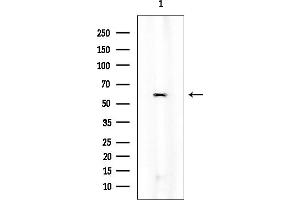 Western blot analysis of lysates from Mouse lung, using HSP60 Mouse Monoclonal Antibody at 1/1000 dilution.