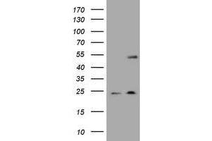 Image no. 4 for anti-Keratin 20 (KRT20) (AA 1-266) antibody (ABIN1490690) (KRT20 anticorps  (AA 1-266))