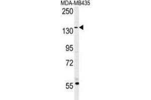 Western blot analysis in MDA-MB435 cell line lysates (35ug/lane) using CD227 / Mucin-1 / MUC1 Antibody . (MUC1 anticorps  (AA 1209-1239))