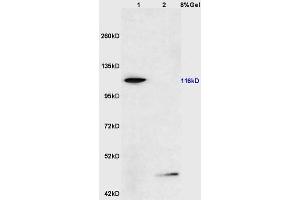 Lane 1: mouse testis lysates Lane 2: mouse pancreas lysates probed with Anti phospho-FAK(Ser722) Polyclonal Antibody, Unconjugated (ABIN711056) at 1:200 in 4 °C.