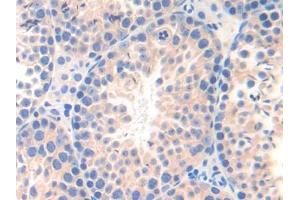 DAB staining on IHC-P; Samples: Mouse Testis Tissue