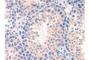 DAB staining on IHC-P; Samples: Mouse Testis Tissue (nectin-3 anticorps  (AA 90-293))