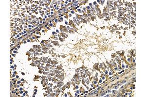 ABIN7095037 and ABIN7099093 at 1/100 staining rat testis tissue by IHC-P.