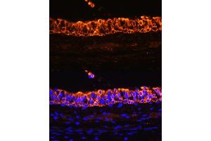 Immunofluorescence analysis of rat bronchus using Cytokeratin 7 (Cytokeratin 7 (KRT7)) antibody (ABIN6129292, ABIN6143037, ABIN6143039 and ABIN6215559) at dilution of 1:100.