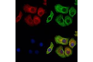 ABIN6258790 and ABIN6275947 staining Hela cells by IF/ICC. (FZD3 anticorps  (Internal Region))